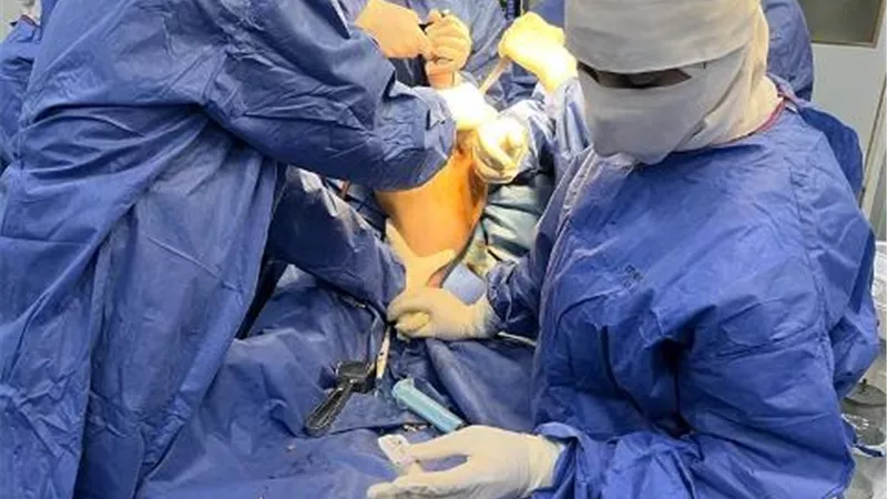 إجراء 8 عمليات تغيير مفصل ركبة بمستشفى الغردقة العام
