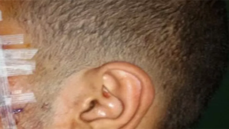 طالب يعتدى على زميلة بسلاح أبيض فى العمرانية