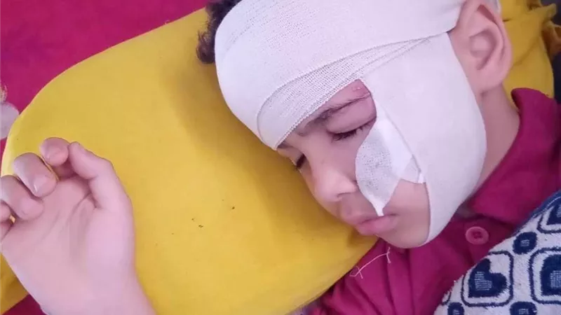 كلب ضال يعقر 4 أطفال بقرية رأس الخليج بالدقهلية