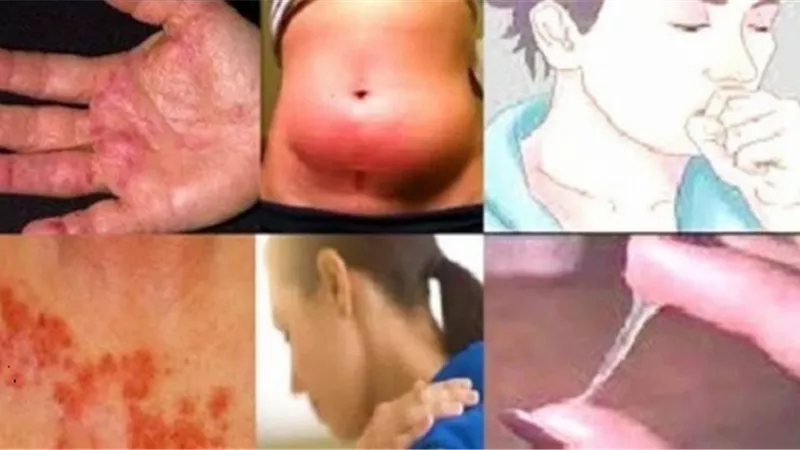 علامات تدل على الاصابة بالسرطان