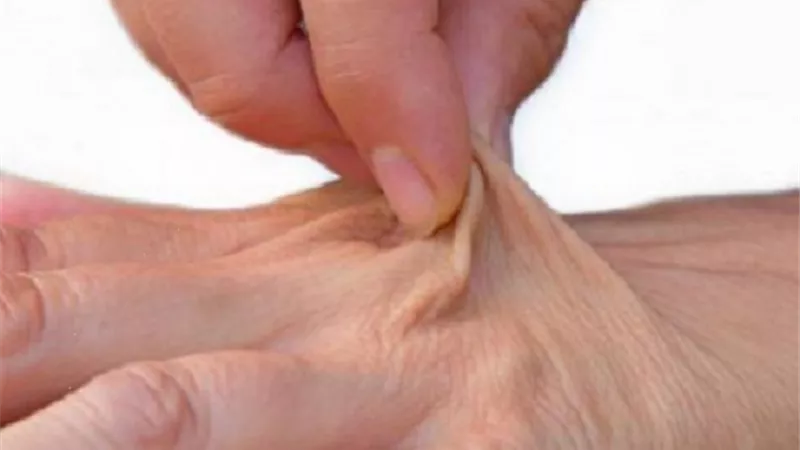احذر الإصابة الجفاف .. إليك 6 علامات مبكرة