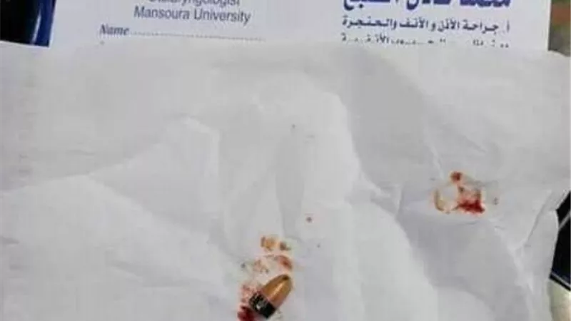 إستخراج سماعة من داخل أذن طالب بالثانوية العامة حاول إخفاءها في الدقهلية