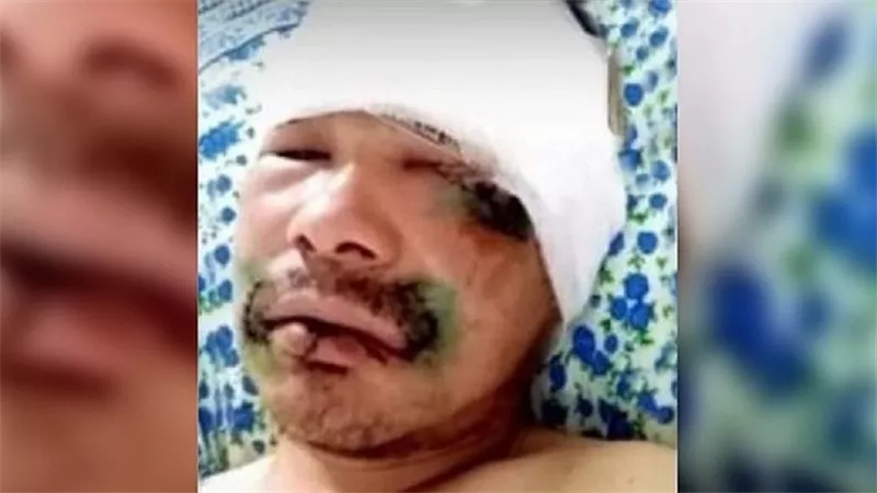يقطع لسان حيوان مفترس لينجو بحياته