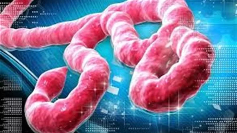 الصحة الأوغندية: وفاة ثانى حالة إصابة بالإيبولا