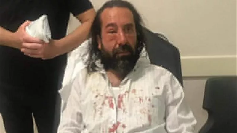 بلطجية أردوغان يسحلون رجل أعمال لدعمه مرشح المعارضة لرئاسة بلدية اسطنبول.. فيديو وصور