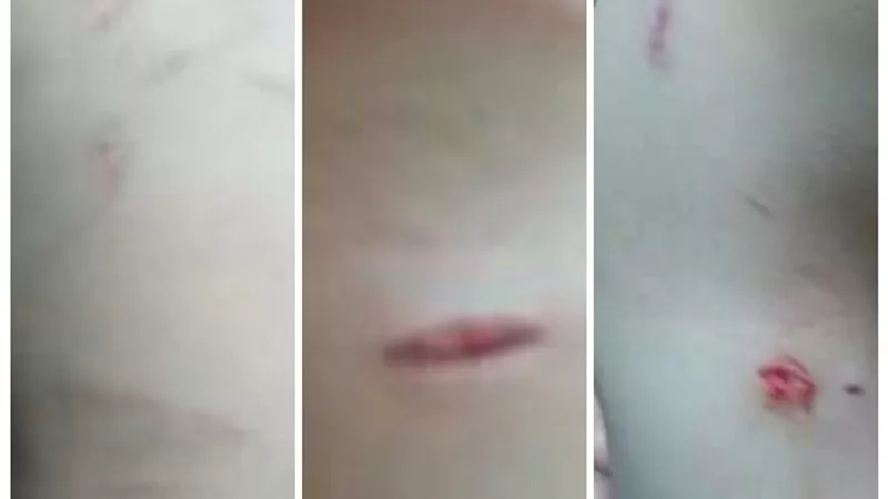 الكلاب الضالة على شاطئ جمصة يمزقون جسم طفل