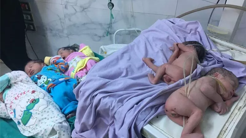 بعد رحلة علاج 8 سنوات سيدة تضع 5 أطفال تؤام بالمحلة