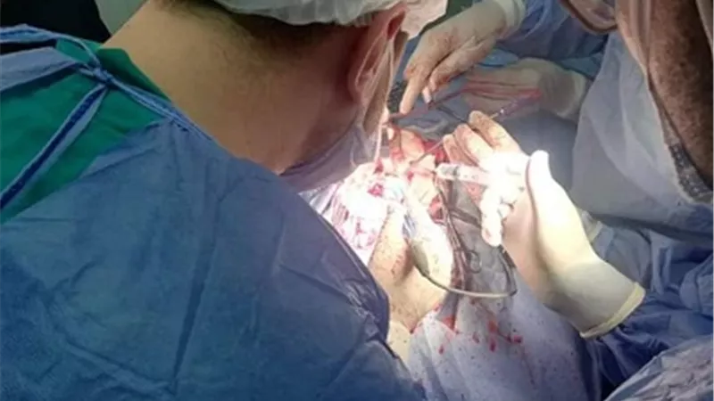 استئصال ورم متعشب من مخ مسنة بمستشفى المنشاوي العام بطنطا
