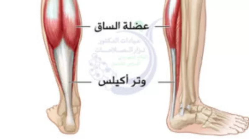 بعد اصابة جنش به .. ٦ معلومات عن وتر اكيلس و علاجه