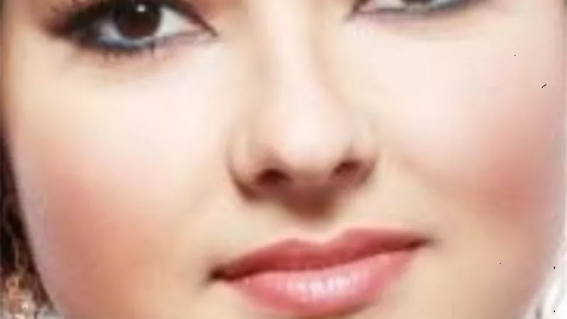 تسمين الوجه