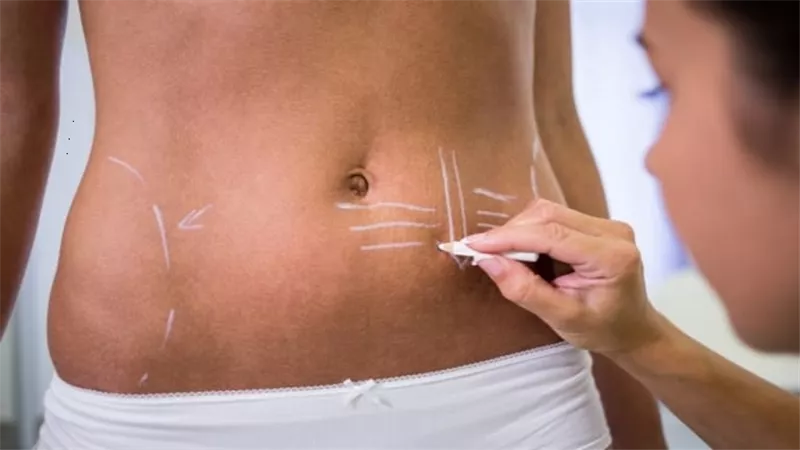 7 اخطاء تسبب ترهلات البطن ..احذرها