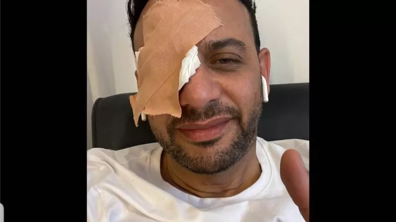 إصابة مصطفي قمر خلال تصوير 