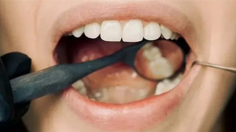 إنذار بمرض السكري.. 6 علامات قد تظهر في الفم