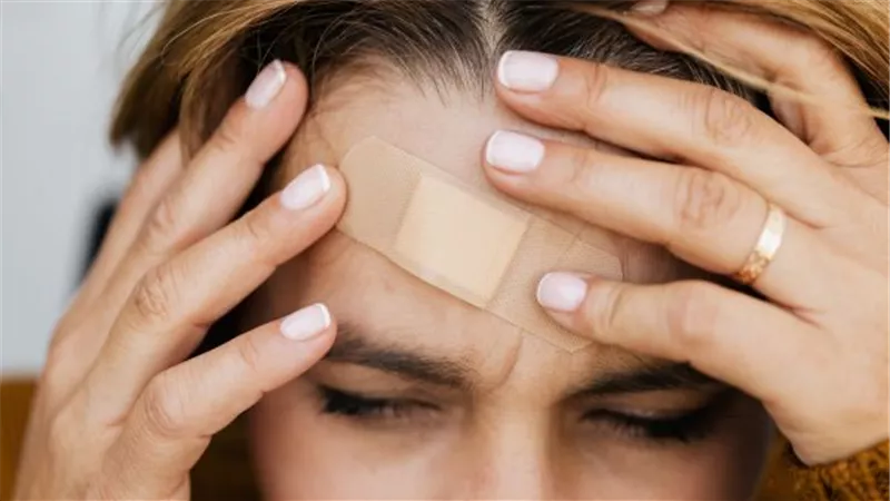 أفضل 3علاجات منزلية لبثور الجبهة