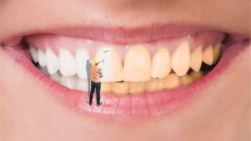 10 طرق آمنة تجعل أسنانك كاللؤلؤ