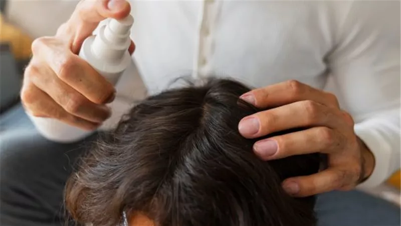 نصائح للاهتمام بفروة رأسك في الصيف