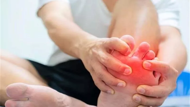 6 خطوات لعلاج النقرس بدون ادوية