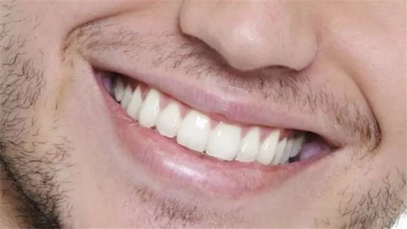 اكتشاف دواء يعيد نمو الأسنان بعد تكسرها أو تلفها