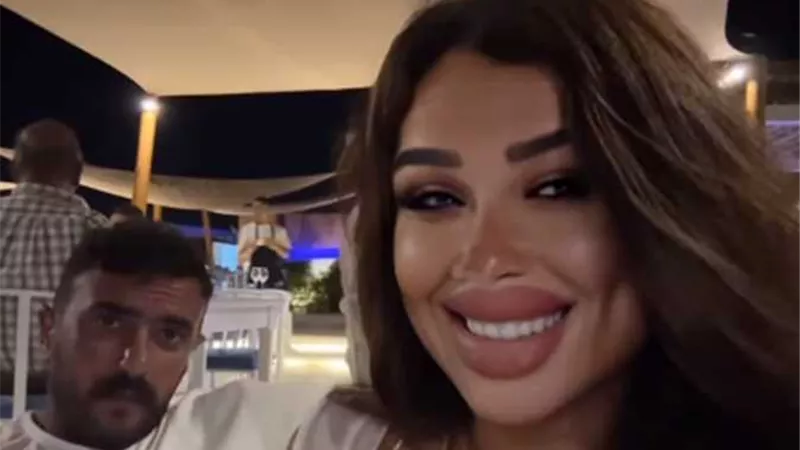 ياسمين عبد العزيز بشفايف منتفخة والعوضي يرد: 