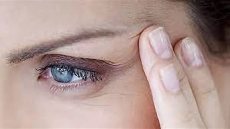 علاج تجاعيد الجفون منزليا