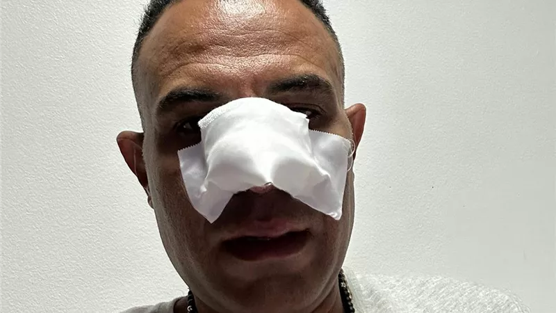 نجاة تامر يحيى مديرأعمال تامر حسني من حادث سيرمروع بطريق العلمين