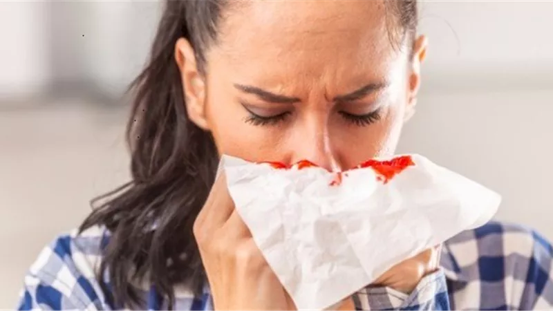 9 اسباب تؤدي لنزيف الانف تعرف عليها