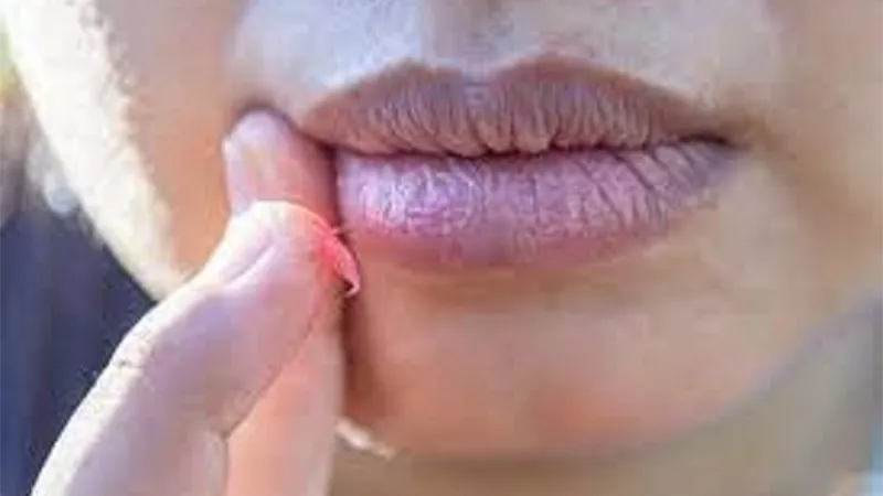 مرض مزمن غير قابل للعلاج