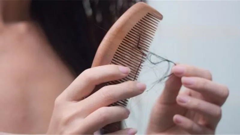 5 اسباب لتساقط شهر المراهقين ..تعرف عليها