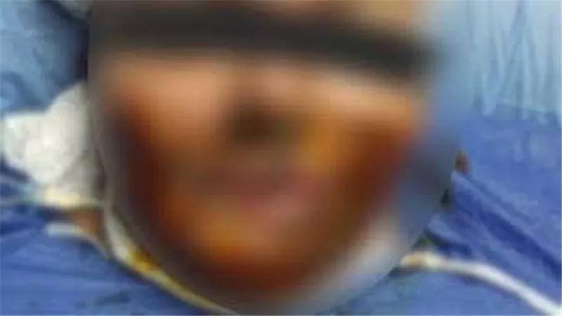 سائق توك توك يلقى ماء نار على ربة منزل ونجلتها بالقناطر الخيرية
