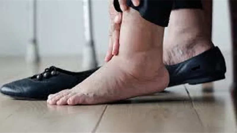 3أعراض مقلقة لتخثر الدم