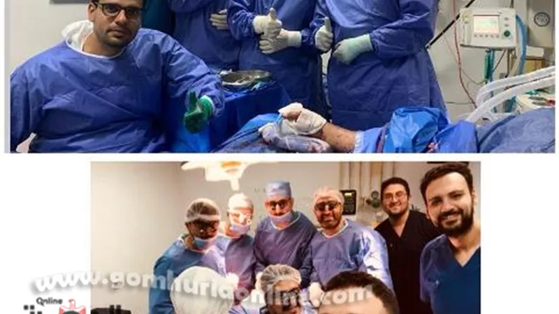 فريـق جراحة التجميل بطب المنوفية ينجح فـي إعادة يـد مبتورة للحركة