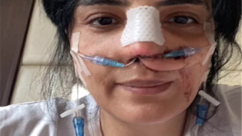 حورية فرغلي تجري اخر عملية فى الأنف.. أصعب وجع إنك تكون لوحدك