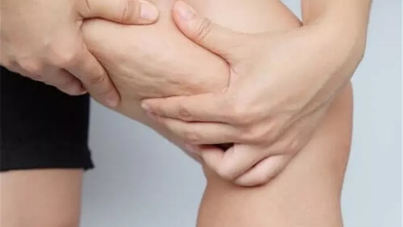 4 استخدامات لخل التفاح للتخلص من السيلوليت