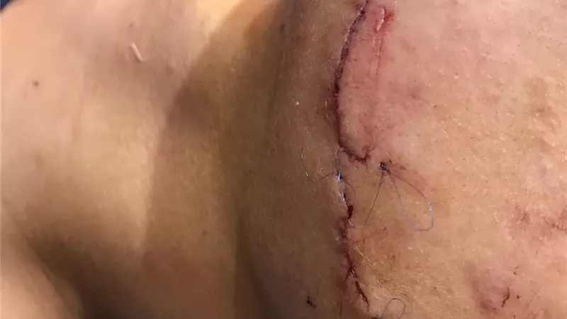 4 طلاب يشوهوا وجه آخر ب 85 غرزة بالسويس