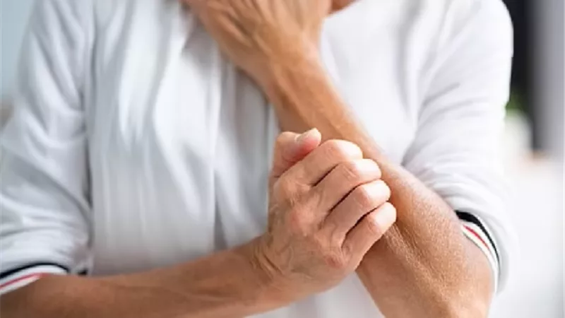 بحث يحل لغز الاصابة بالحكة المستمرة
