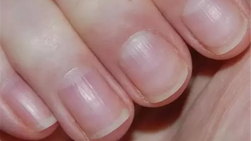 8 خطوات لاظافر قوية..تعرف عليها