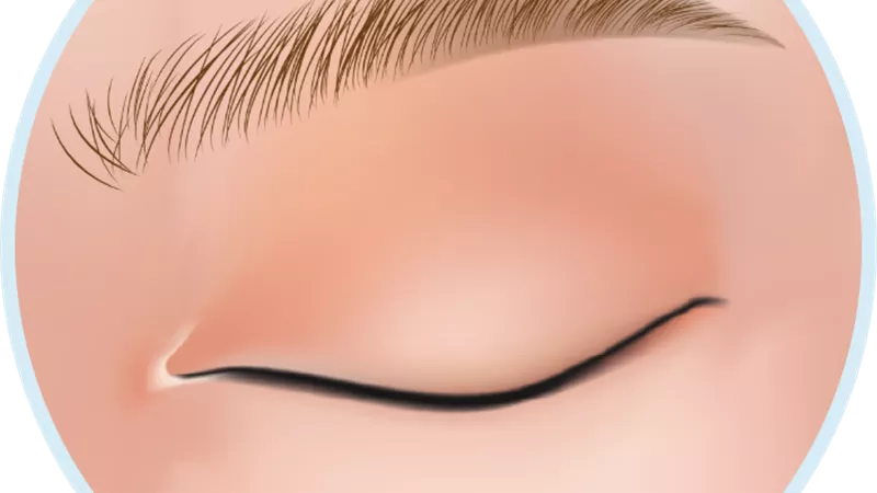 مشروعية عمليات تجميل رفع الحواجب